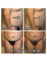 りんと/痩身　ダイエット