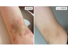 トパーズ 掛川店(Topaz)/リアボーテ クレアスキン使用