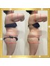 当店人気Ｎｏ.1♪人生変わる【美ボディダイエット痩身】マイナス10kgコース！