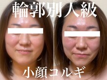 ベリンダ(belinda)/大人気の整形級小顔コルギで別人