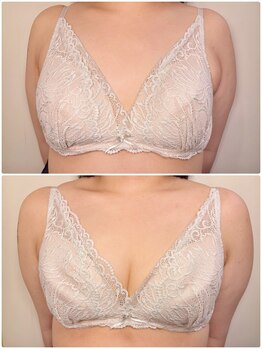 アンシャンテ(ENCHANTER)/光バストアップ