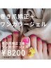 【フット巻き爪矯正】巻爪矯正＋ワンカラーフットジェル￥8200