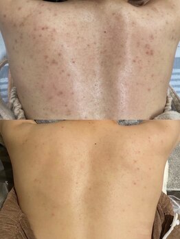 シャイネル(SHYNELL)/