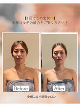 遠賀サロン/ビフォーアフター