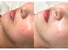 ウォナ(WONA)/【お客様症例】