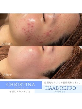 フルアナ(Hu ruana)/フェイシャルエステ