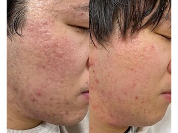 ミレット(Miretto)/