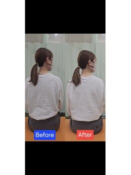 最後の整体 練馬駅前院/肩こりでお悩みの方の可動域