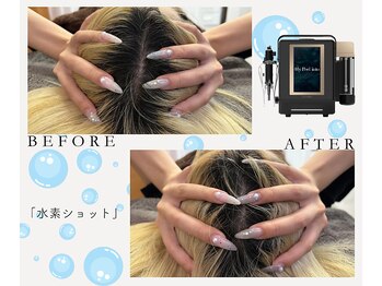 ルームエイトエイティスリー 新宿(R883)/小顔を叶える水素ショット