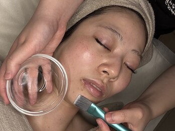 ミー(miii)/施術４、ピーリング