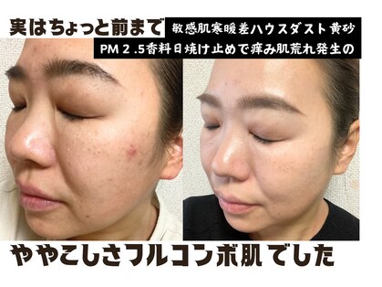 ギフト(gift)の写真