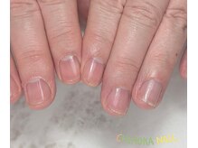 チモカネイル(CHIMOKA NAIL)/ケイルケア