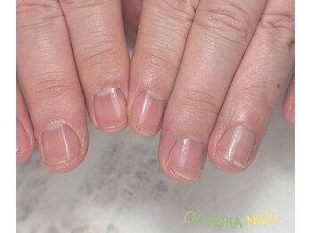 チモカネイル(CHIMOKA NAIL)/ケイルケア