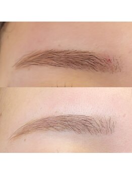 顔肌革命 ビューティアンドヘルス バイ メール(beauty&health by mer)/眉毛ワックス×おでこワックス