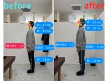 トワニ整体 新富町院(TOWANI整体)/姿勢/銀座/新富町/築地/整体