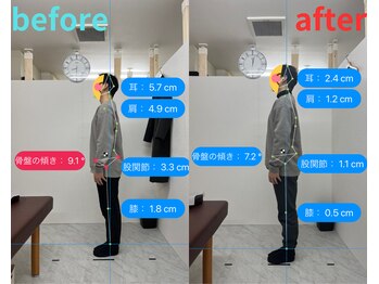 トワニ整体 新富町院(TOWANI整体)/姿勢/銀座/新富町/築地/整体