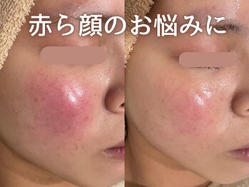 ブルーエム 大森(Blue-M)/