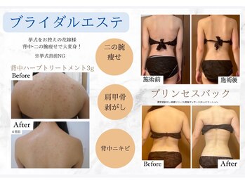 リアンビューティー(Lien Beauty)