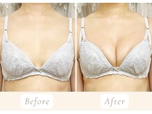 ノルン(Norn)の雰囲気（光豊胸＋乳腺マッサージで美乳＆育乳☆理想のバストへ）