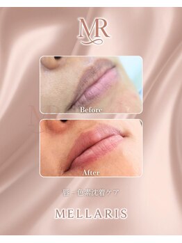 エスペランサ(Esperanza)/Lip Pink Care