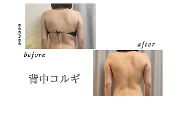 リリー(Lily)/背中コルギ