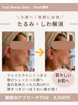 ストック 浦和(Stock)/たるみすっきり小顔へ導く