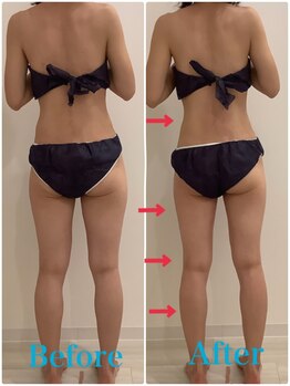 スペチアーレ 夙川/脚長効果抜群♪