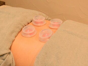 リョウちゃん整体/カッピング