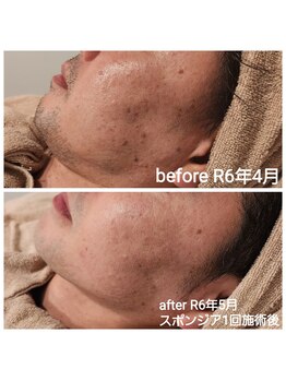 ルオント(LUONTO)/男性にも人気☆気になるシミケア