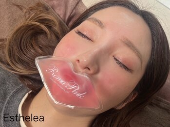 エステレア(Esthelea)の写真/【肌の黒ずみに悩む女性の方必見】「ローマピンク」は唇・バストトップ・VIO等無針で肌の黒ずみを除去★