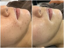 碧いしずくの雰囲気（ハーブは、デトックス・肌代謝アップで肌悩みを解決！陶器肌に！）