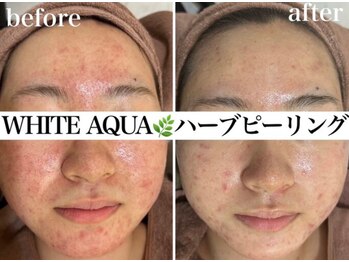 ホワイトアクア 四日市店(WHITE AQUA)/結果重視サロン四日市ハーブ