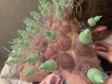 骨気(コルギ)専門店 YONG miu【ヨング ミュー】/カッピング【首肩こり】