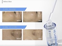 アンドミー 大阪梅田店(&me)/セラピール【艶/美白/くすみ】