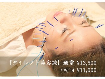 アモ(amo)/ダイレクト美容鍼