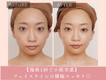 サロン ド リアン(salon de lien)/施術1回で小顔&むくみスッキリ☆