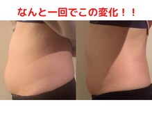 モモ 三ノ宮店(momo)/１回でも痩身変化を実感♪