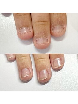 キラネイル アンド アイラッシュ by World Beauty(KIRA)/#新潟自爪育成