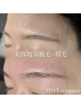 サロンロンウーマン(SALON RON woman)/眉毛脱毛