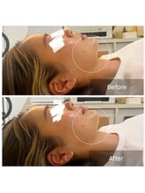 ウィズ ユー ビューティ(with U beauty)/立体的に！！