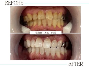 ホワイトニングサロンブライト 尼崎店(Whitening salon bright)/ハロウィンやイベント前に(^▽^)