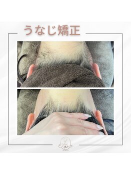 ミース 宮崎店/うなじ脱毛でめちゃめちゃ変わる