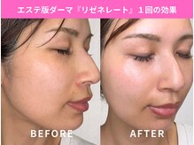 マリナビューティーサロン(Malina BEAUTY SALON)の雰囲気（毛穴レス＆韓国ツヤ肌◎ワントーンUPで美肌を目指す施術）