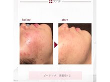 サロンドゥレーヴシエル(Salon de reve Ciel...)/【WOVEstyle】トリートメント 