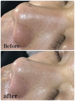 ジョルフ サロン オリジナル(JOLF salon original)/エインBefore、after