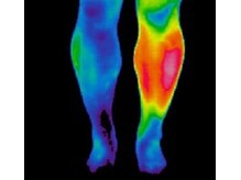 おおむらさき整体院/炭ホットストーンの効果（脚）