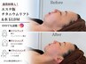 ショット数倍！即効性抜群◆エステ版チタニウムリフト(首/全顔)＋水玉LDM
