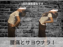 ハリユナイテッド 原宿鍼灸 整体院(HALI UNITED)/腰痛とサヨウナラ！