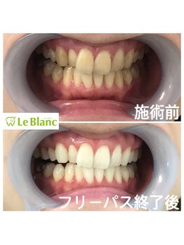 ルブラン 奈良店(Le Blanc)/ご都合の良い日に