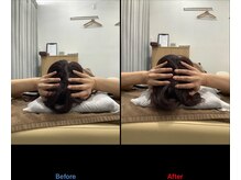 デン整骨院(DEN整骨院)/小顔矯正/フェイスライン/むくみ